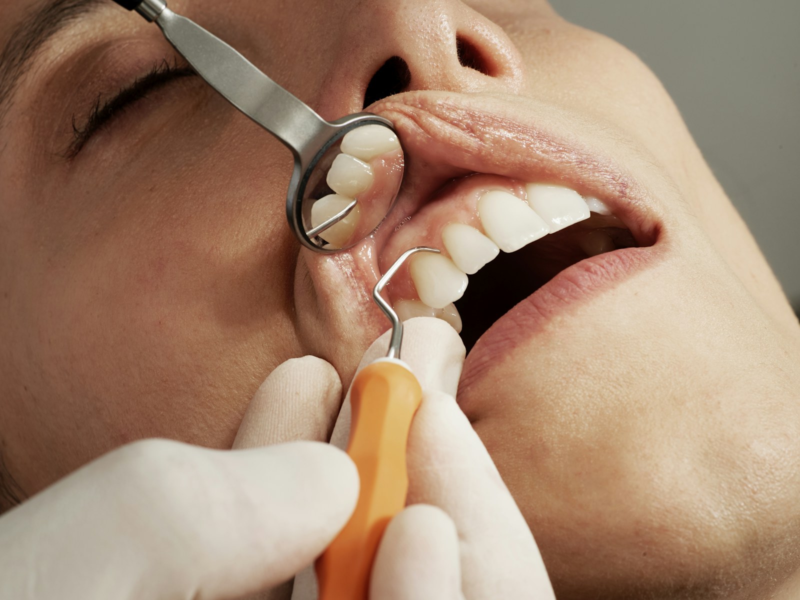 Imagem ilustrativa — Odontologia — Decare
